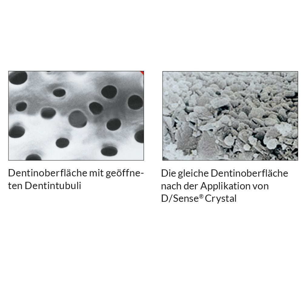 D/Sense Crystal - Image 3