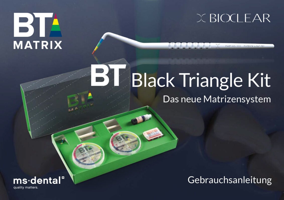 Black Triangle Kit