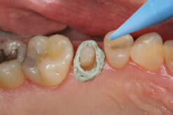 Alternative view of Access Flo