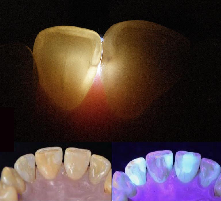 Microlux DW Illuminator Kit - Image 4