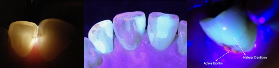 Microlux DW Illuminator Kit - Image 3