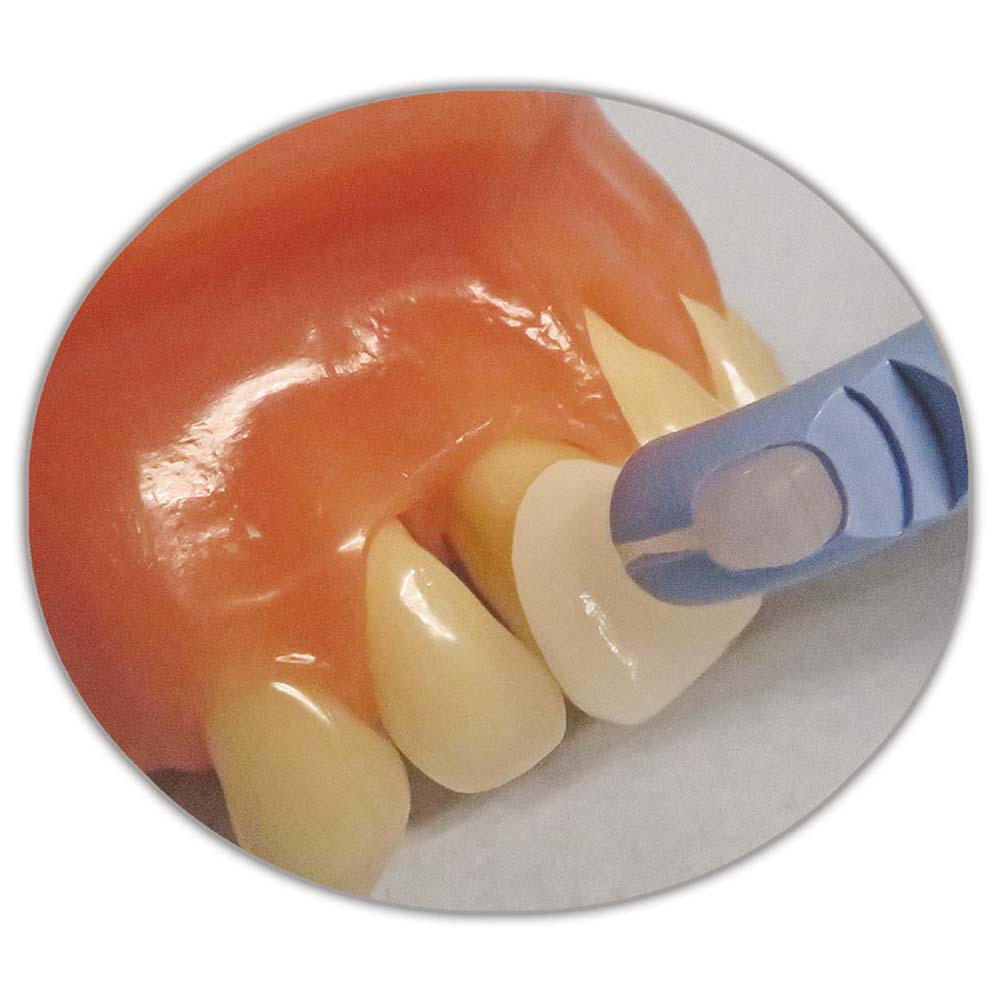 VAC-TAK Veneer Placement