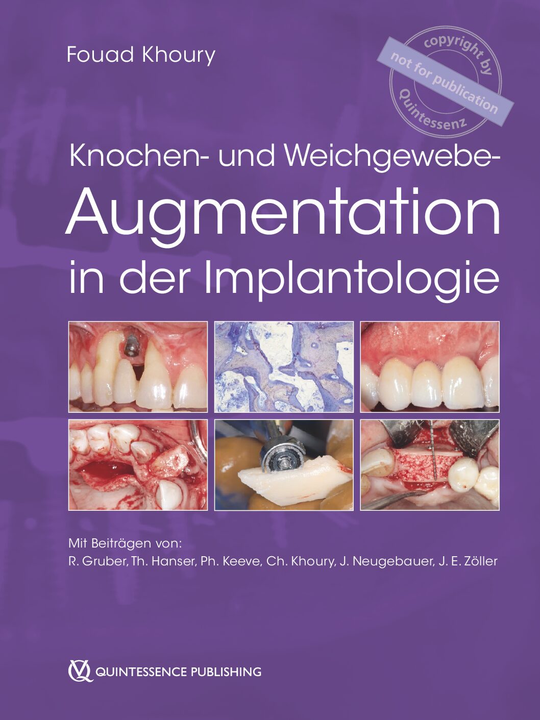 Mund-Kiefer-Gesichtschirurgie