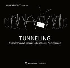Tunneling