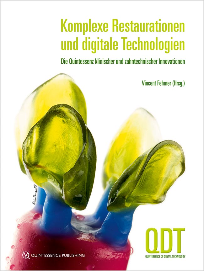 Komplexe Restaurationen und digitale Technologien (QDT Jahrbuch 2024)
