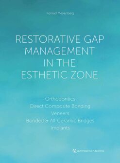 Restorative Gap Management in the Esthetic Zone