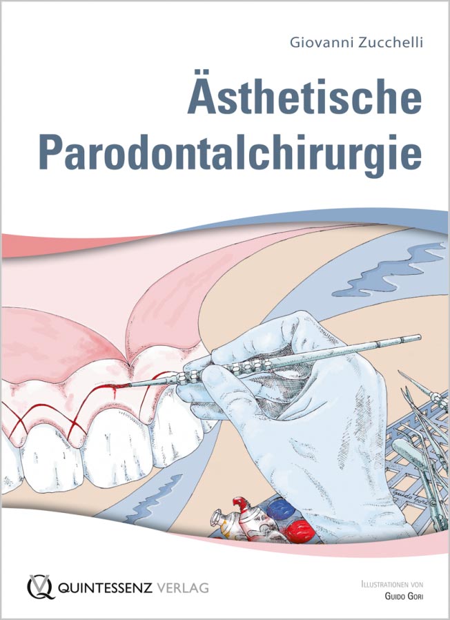 Ästhetische Parodontalchirurgie
