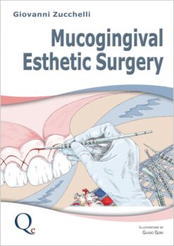 Mucogingival Esthetic Surgery