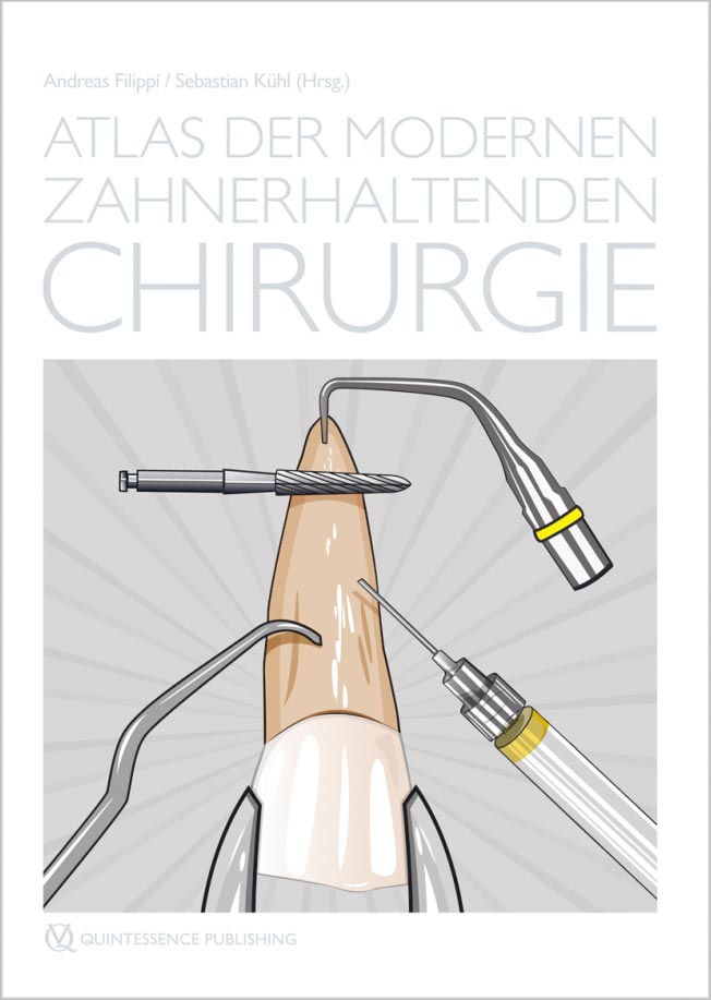 Atlas der modernen zahnerhaltenden Chirurgie
