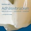 Adhäsivbrücken