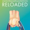 Zahntransplantation Reloaded