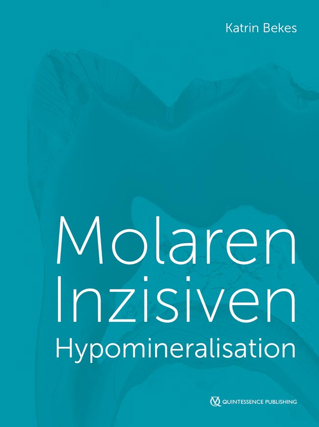 Molaren-Inzisiven Hypomineralisation