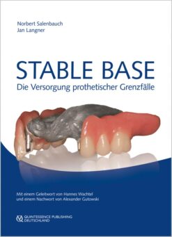 Stable Base: Die Versorgung prothetischer Grenzfälle