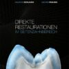 Direkte Restaurationen im Seitenzahnbereich