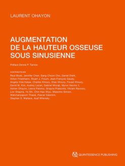 Augmentation de la hauteur osseuse sous sinusienne